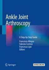 Ankle Joint Arthroscopy: A Step-by-Step Guide