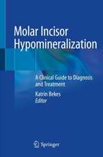 Molar Incisor Hypomineralization: A Clinical Guide to Diagnosis and Treatment