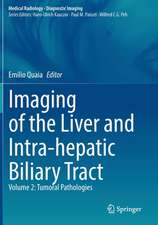 Imaging of the Liver and Intra-hepatic Biliary Tract: Volume 2: Tumoral Pathologies