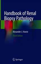 Handbook of Renal Biopsy Pathology