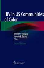 HIV in US Communities of Color