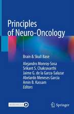 Principles of Neuro-Oncology: Brain & Skull Base