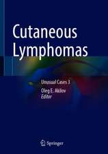 Cutaneous Lymphomas: Unusual Cases 3