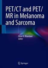 PET/CT and PET/MR in Melanoma and Sarcoma