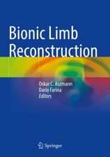 Bionic Limb Reconstruction