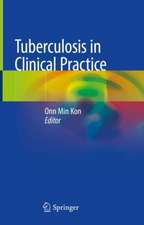 Tuberculosis in Clinical Practice