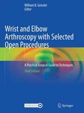 Wrist and Elbow Arthroscopy with Selected Open Procedures