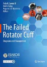 The Failed Rotator Cuff