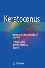 Keratoconus