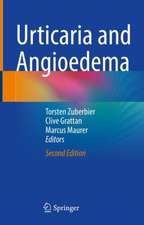 Urticaria and Angioedema