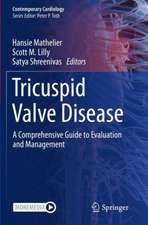 Tricuspid Valve Disease: A Comprehensive Guide to Evaluation and Management