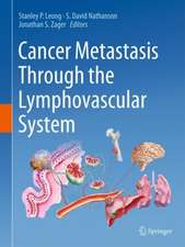 Cancer Metastasis Through the Lymphovascular System