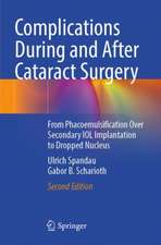 Complications During and After Cataract Surgery: From Phacoemulsification Over Secondary IOL Implantation to Dropped Nucleus