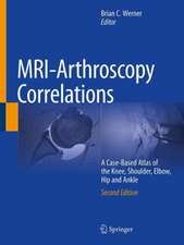 MRI-Arthroscopy Correlations