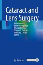 Cataract and Lens Surgery