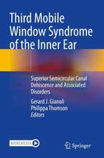 Third Mobile Window Syndrome of the Inner Ear: Superior Semicircular Canal Dehiscence and Associated Disorders