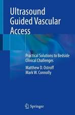 Ultrasound Guided Vascular Access