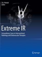 Extreme IR: Extraordinary Cases in Interventional Radiology and Endovascular Therapies