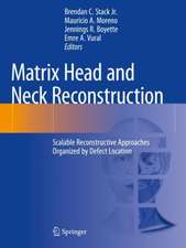 Matrix Head and Neck Reconstruction