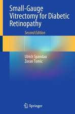 Small-Gauge Vitrectomy for Diabetic Retinopathy