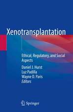 Xenotransplantation: Ethical, Regulatory, and Social Aspects