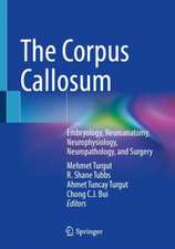 The Corpus Callosum