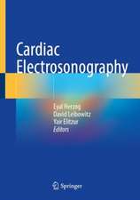 Cardiac Electrosonography