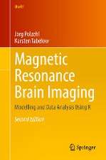 Magnetic Resonance Brain Imaging: Modelling and Data Analysis Using R