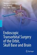 Endoscopic Transorbital Surgery of the Orbit, Skull Base and Brain