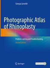 Photographic Atlas of Rhinoplasty: Problem-solving and Troubleshooting