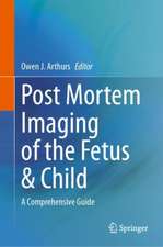 Post Mortem Imaging of the Fetus & Child: A Comprehensive Guide