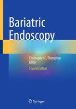 Bariatric Endoscopy