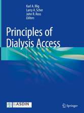 Principles of Dialysis Access