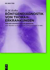 Röntgendiagnostik von Thoraxerkrankungen: Von der Deskription zur Diagnose