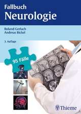 Fallbuch Neurologie