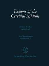 Lesions of the Cerebral Midline: 9th Scientific Meeting of the European Society for Paediatric Neurosurgery (ESPN), October 10–13, 1984, Vienna