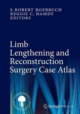 Limb Lengthening and Reconstruction Surgery Case Atlas