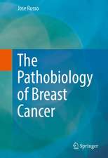 The Pathobiology of Breast Cancer