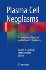 Plasma Cell Neoplasms: Pathogenesis, Diagnosis and Laboratory Evaluation