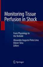 Monitoring Tissue Perfusion in Shock