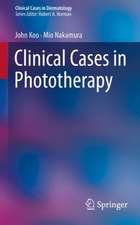 Clinical Cases in Phototherapy