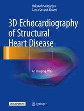 3D Echocardiography of Structural Heart Disease