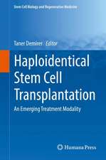 Haploidentical Stem Cell Transplantation