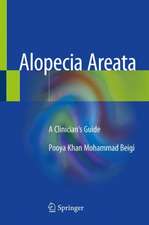 Alopecia Areata: A Clinician's Guide