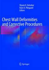 Chest Wall Deformities and Corrective Procedures