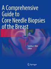 A Comprehensive Guide to Core Needle Biopsies of the Breast 