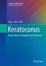 Keratoconus: Recent Advances in Diagnosis and Treatment