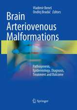 Brain Arteriovenous Malformations: Pathogenesis, Epidemiology, Diagnosis, Treatment and Outcome