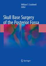 Skull Base Surgery of the Posterior Fossa