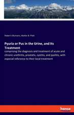 Pyuria or Pus in the Urine, and Its Treatment